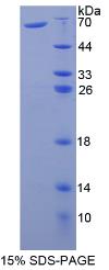 SDS-PAGE (F2-698H).jpg